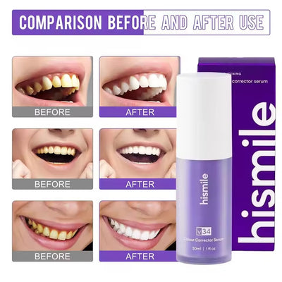 Purple Teeth Whitening Purple Toothpaste White Teeth Toothpaste For Pain Sensitive Teeth Teeth Whitening Toothpaste