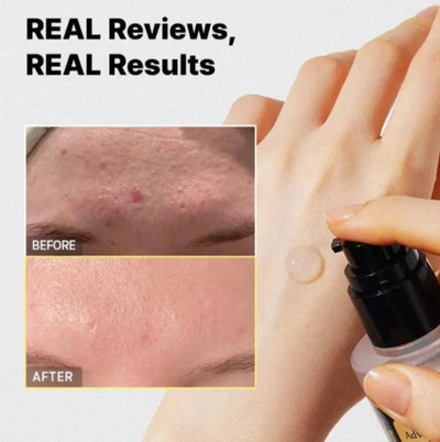 COSRX Advanced Snail 96 Mucin Power Essence – Hydrating, Repairing & Brightening Korean Face Essence