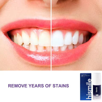 Purple Teeth Whitening Purple Toothpaste White Teeth Toothpaste For Pain Sensitive Teeth Teeth Whitening Toothpaste